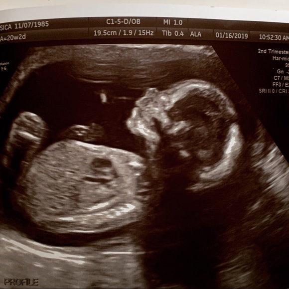 My sweet family🥰❤️ - Picture 5 of 8